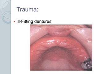 Trauma:<br />Ill-Fitting dentures<br />