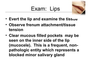Exam: Lips
• Evert the lip and examine the tissue
• Observe frenum attachment/tissue
tension
• Clear mucous filled pockets may be
seen on the inner side of the lip
(mucocele). This is a frequent, non-
pathologic entity which represents a
blocked minor salivary gland
 