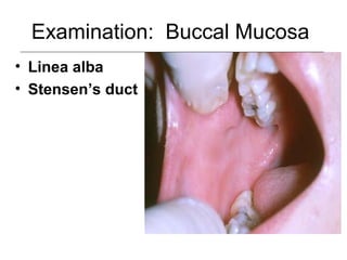Examination: Buccal Mucosa
• Linea alba
• Stensen’s duct
 
