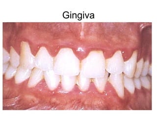 Gingiva
 