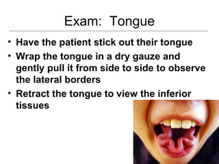 Exam: Tongue
• Have the patient stick out their tongue
• Wrap the tongue in a dry gauze and
gently pull it from side to side to observe
the lateral borders
• Retract the tongue to view the inferior
tissues
 
