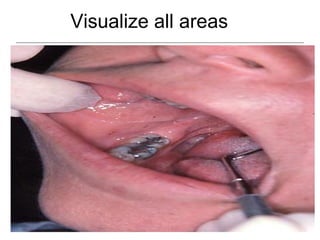 Visualize all areas
 