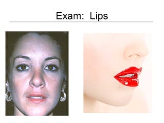 Exam: Lips
 