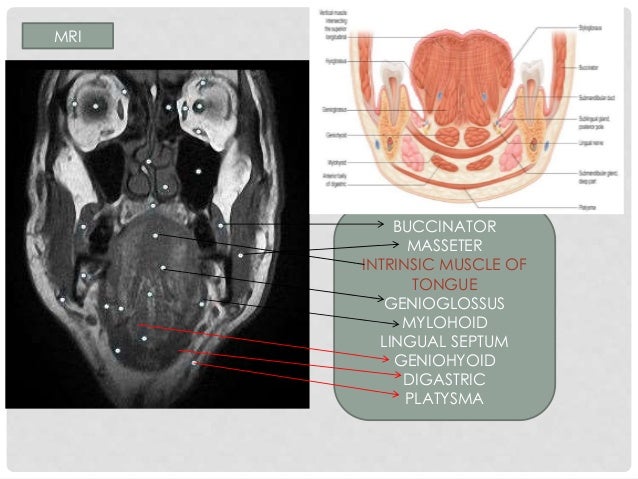 Oral Cavity Pharynx