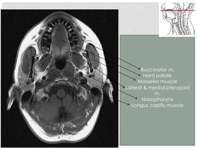 Oral cavity, pharynx