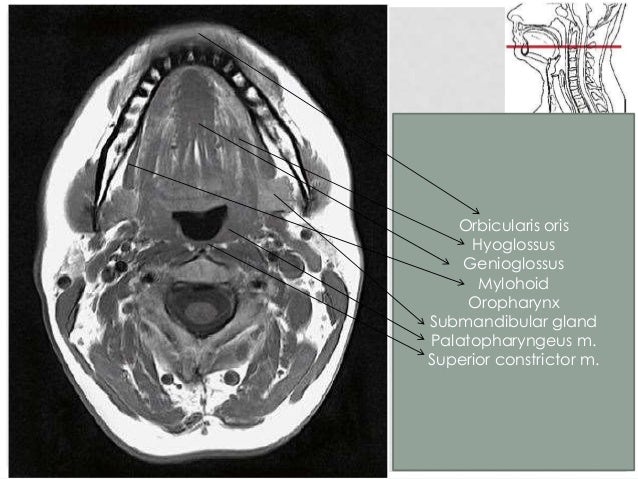 Oral Cavity Pharynx Radio Anatomy