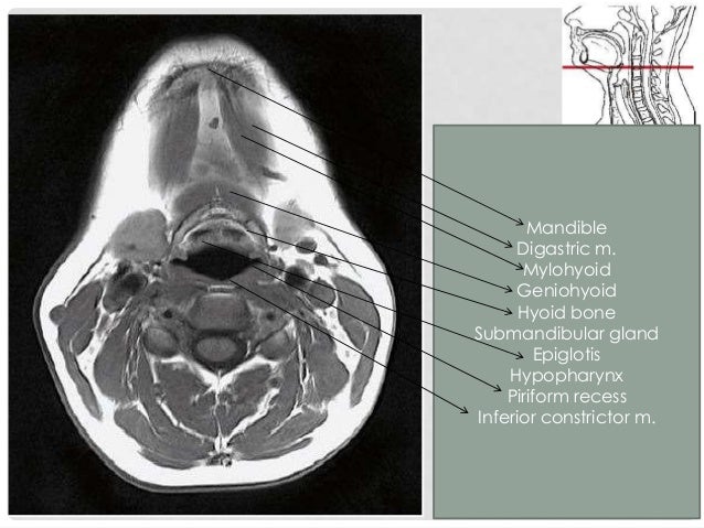 Oral cavity, pharynx radio-anatomy