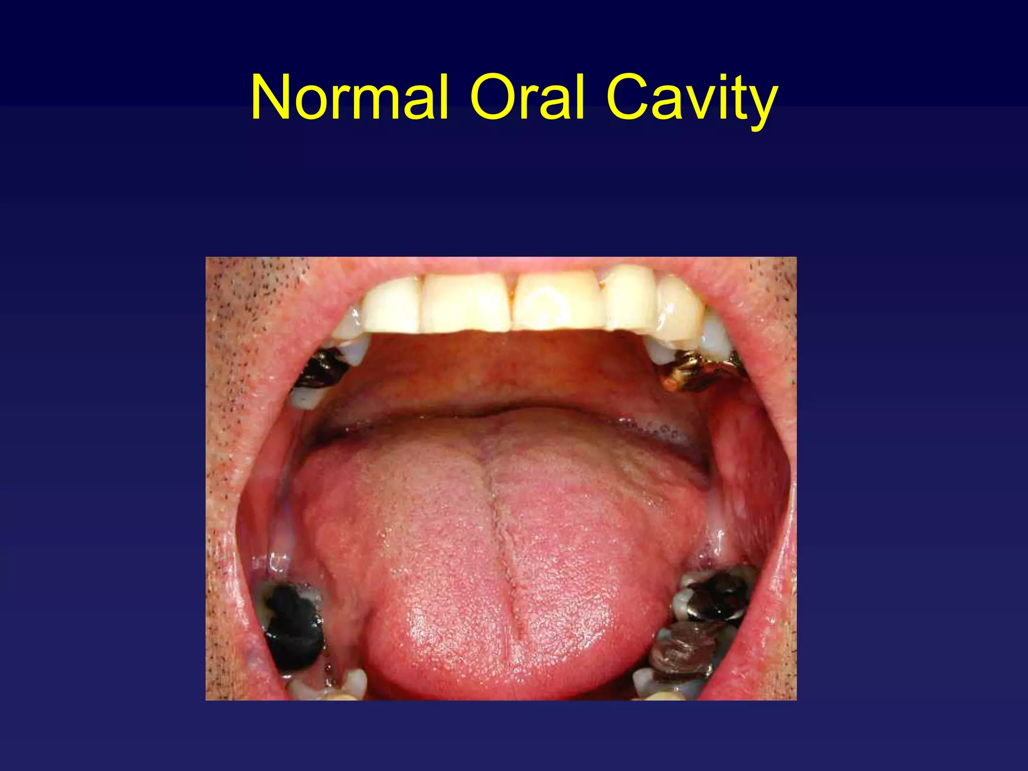 Oral cavity Ppt internet.ppt