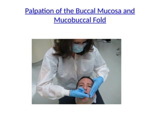 Palpation of the Buccal Mucosa and
Mucobuccal Fold
 