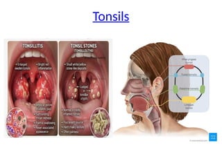 Tonsils
 
