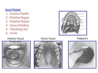 Hard Palate
1. Incisive Papilla
2. Palatine Rugae
3. Palatine Raphe
4. Fovea Palatina
5. Vibrating Line
6. Uvula
Indirect Visual
Inspection
Direct Visual
Inspection
Palpation
 