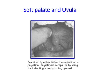 Examined by either indirect visualization or
palpation. Palpation is completed by using
the index finger and pressing upward
Soft palate and Uvula
 