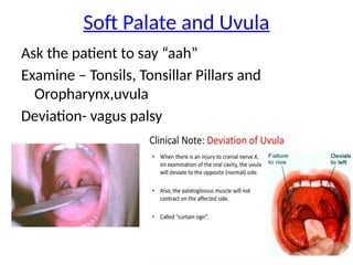 Soft Palate and Uvula
Ask the patient to say “aah”
Examine – Tonsils, Tonsillar Pillars and
Oropharynx,uvula
Deviation- vagus palsy
 