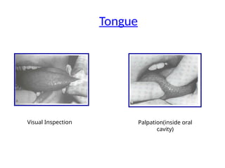 Tongue
Visual Inspection Palpation(inside oral
cavity)
 