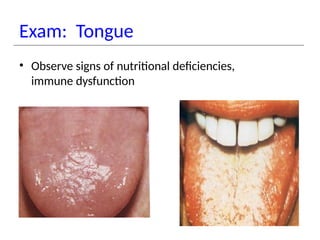 Exam: Tongue
• Observe signs of nutritional deficiencies,
immune dysfunction
 