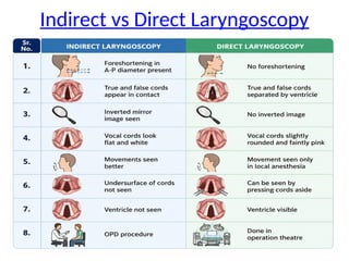 Indirect vs Direct Laryngoscopy
 
