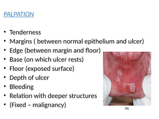 PALPATION
• Tenderness
• Margins ( between normal epithelium and ulcer)
• Edge (between margin and floor)
• Base (on which ulcer rests)
• Floor (exposed surface)
• Depth of ulcer
• Bleeding
• Relation with deeper structures
• (Fixed – malignancy)
 