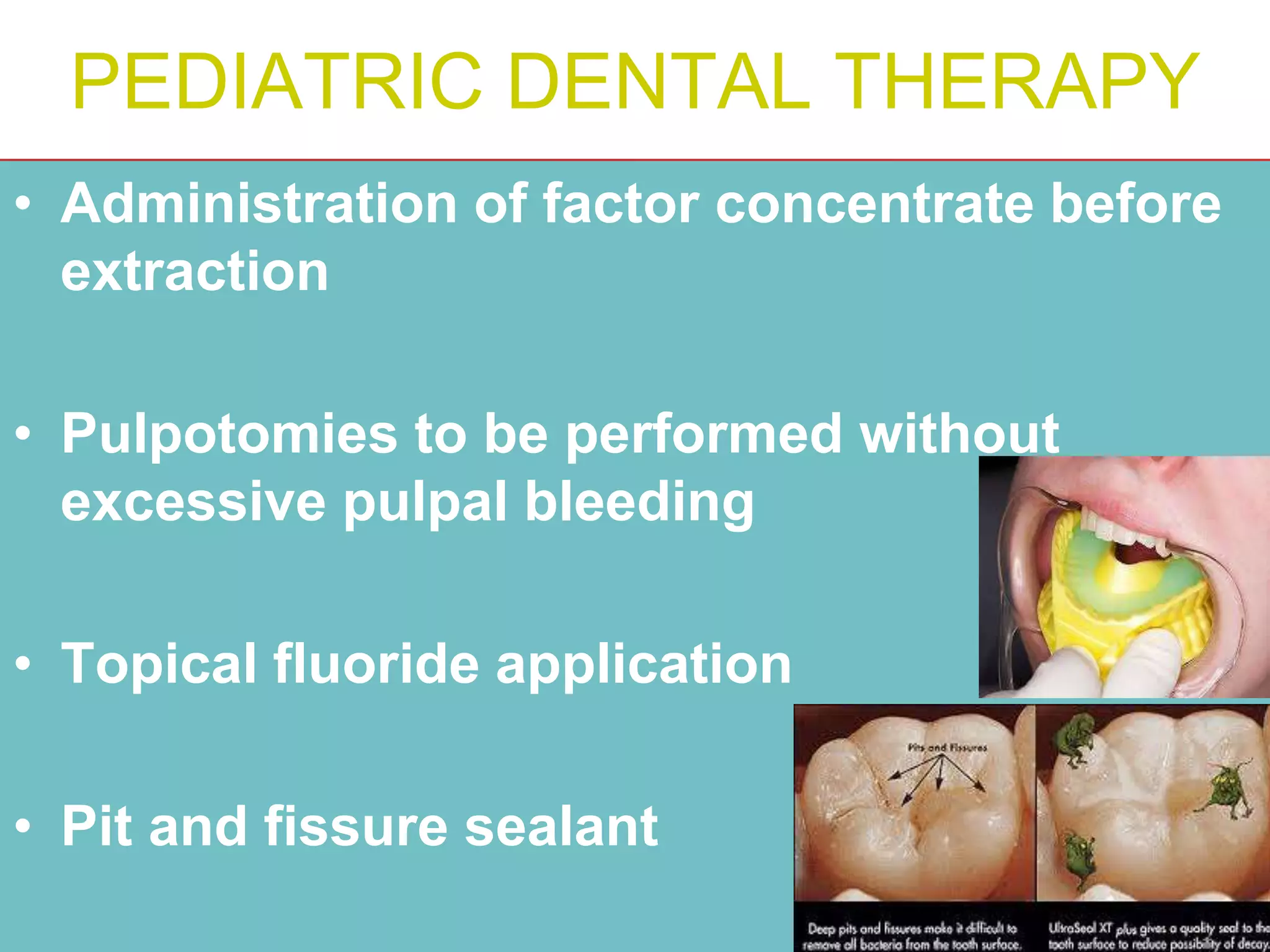 PEDIATRIC DENTAL THERAPY
• Administration of factor concentrate before
extraction
• Pulpotomies to be performed without
excessive pulpal bleeding
• Topical fluoride application
• Pit and fissure sealant
 
