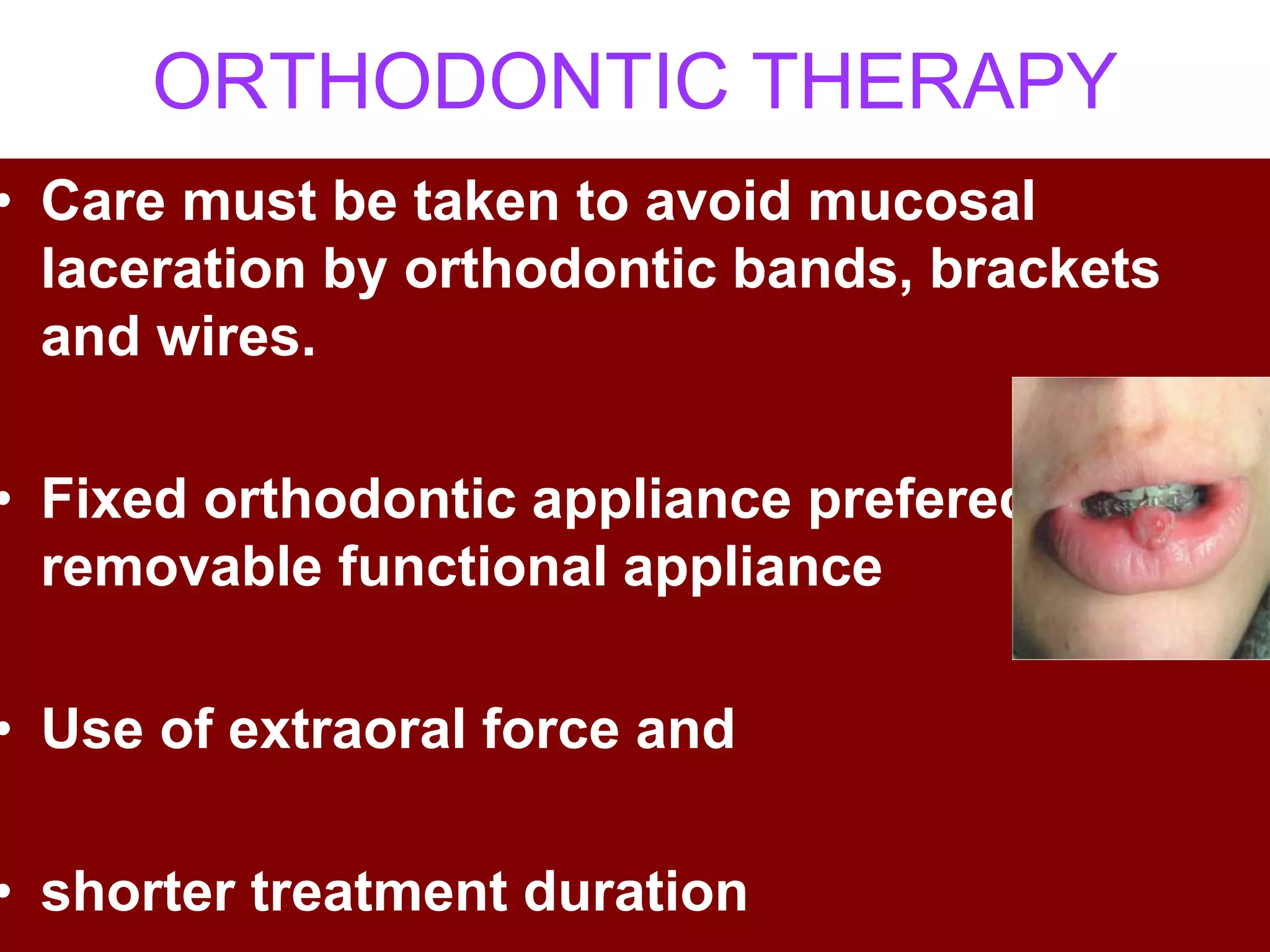ORTHODONTIC THERAPY
• Care must be taken to avoid mucosal
laceration by orthodontic bands, brackets
and wires.
• Fixed orthodontic appliance prefered over
removable functional appliance
• Use of extraoral force and
• shorter treatment duration
 