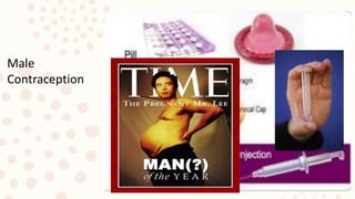 Male
Contraception
 