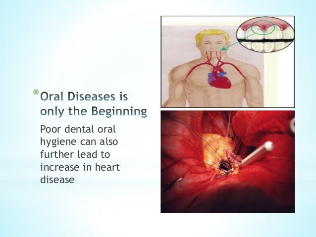 Importance of oral hygiene essay picture
