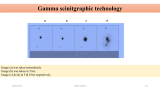 28/05/2016 SAGAR SAVALE 121
Gamma scinitgraphic technology
Image (a) was taken immediately
Image (b) was taken at 3 hrs.
Image (c) & (d) at 5 & 6 hrs respectively.
a b c d
 