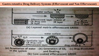 Gastro retentive Drug Delivery Systems (Effervescent and Non Effervescent)
28/05/2016 79SAGAR SAVALE
 