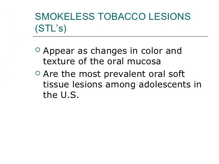 Oral effects of_smokeless_tobacco