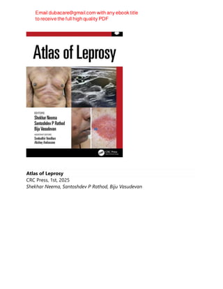 Atlas of Leprosy
CRC Press, 1st, 2025
Shekhar Neema, Santoshdev P Rathod, Biju Vasudevan
 