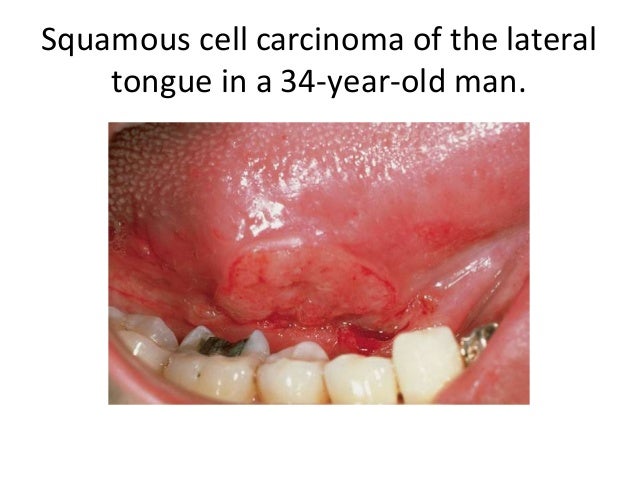Cells Of The Mouth 34