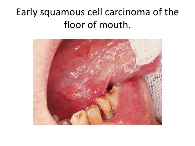 Cells Of The Mouth 81