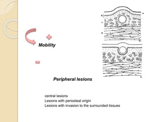 Mobility
Peripheral lesions
central lesions
Lesions with periosteal origin
Lesions with invasion to the surrounded tissues
 