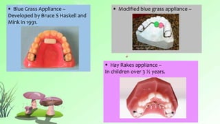 dentistry oral habit dentistry oral habit oral habit.pptx