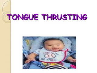 TONGUE THRUSTING

 