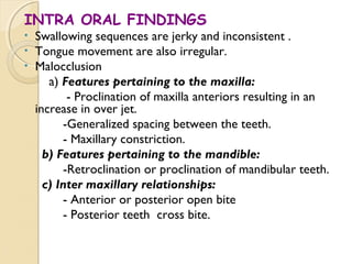 INTRA ORAL FINDINGS
•
•
•

Swallowing sequences are jerky and inconsistent .
Tongue movement are also irregular.
Malocclusion
a) Features pertaining to the maxilla:
- Proclination of maxilla anteriors resulting in an
increase in over jet.
-Generalized spacing between the teeth.
- Maxillary constriction.
b) Features pertaining to the mandible:
-Retroclination or proclination of mandibular teeth.
c) Inter maxillary relationships:
- Anterior or posterior open bite
- Posterior teeth cross bite.

 