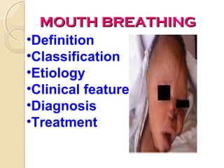 MOUTH BREATHING
•Definition
•Classification
•Etiology
•Clinical feature
•Diagnosis
•Treatment

 