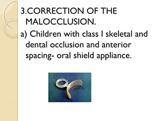 3.CORRECTION OF THE
MALOCCLUSION.
a) Children with class l skeletal and
dental occlusion and anterior
spacing- oral shield appliance.

 