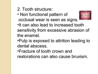 2. Tooth structure:
• Non functional pattern of
occlusal wear is seen as signs.
•It can also lead to increased tooth
sensitivity from excessive abrasion of
the enamel.
•Pulp is exposed to attrition leading to
dental abscess.
•Fracture of tooth crown and
restorations can also cause bruxism.

 