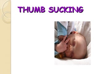 THUMB SUCKING

 