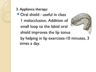 3. Appliance therapy:
Oral

shield : useful in class
1 malocclusion. Addition of
small loop to the labial oral
shield improves the lip tonus
by helping in lip exercises-10 minutes, 3
times a day.

 