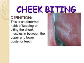 CHEEK BITING
DEFINITION:
This is an abnormal
habit of keeping or
biting the cheek
muscles in between the
upper and lower
posterior teeth.

 