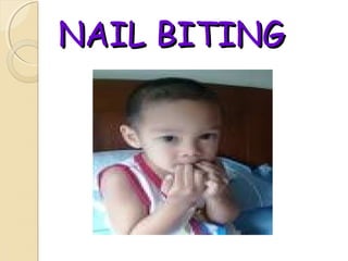NAIL BITING

 