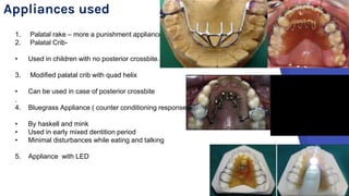Paltal Rake Oral habits 2018 | PPTX