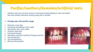 Oral Habits In Children(Thumb Sucking,Tongue Thrusting, Mouth Breathing ...