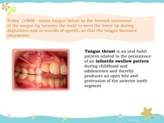 Oral habits - Thumb Sucking and Tongue Thrusting | PPTX