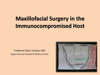 Maxillofacial Surgery in the Immunocompromised Host  Frederick Mars Untalan MD Baguio General Hospital & Medical Center 