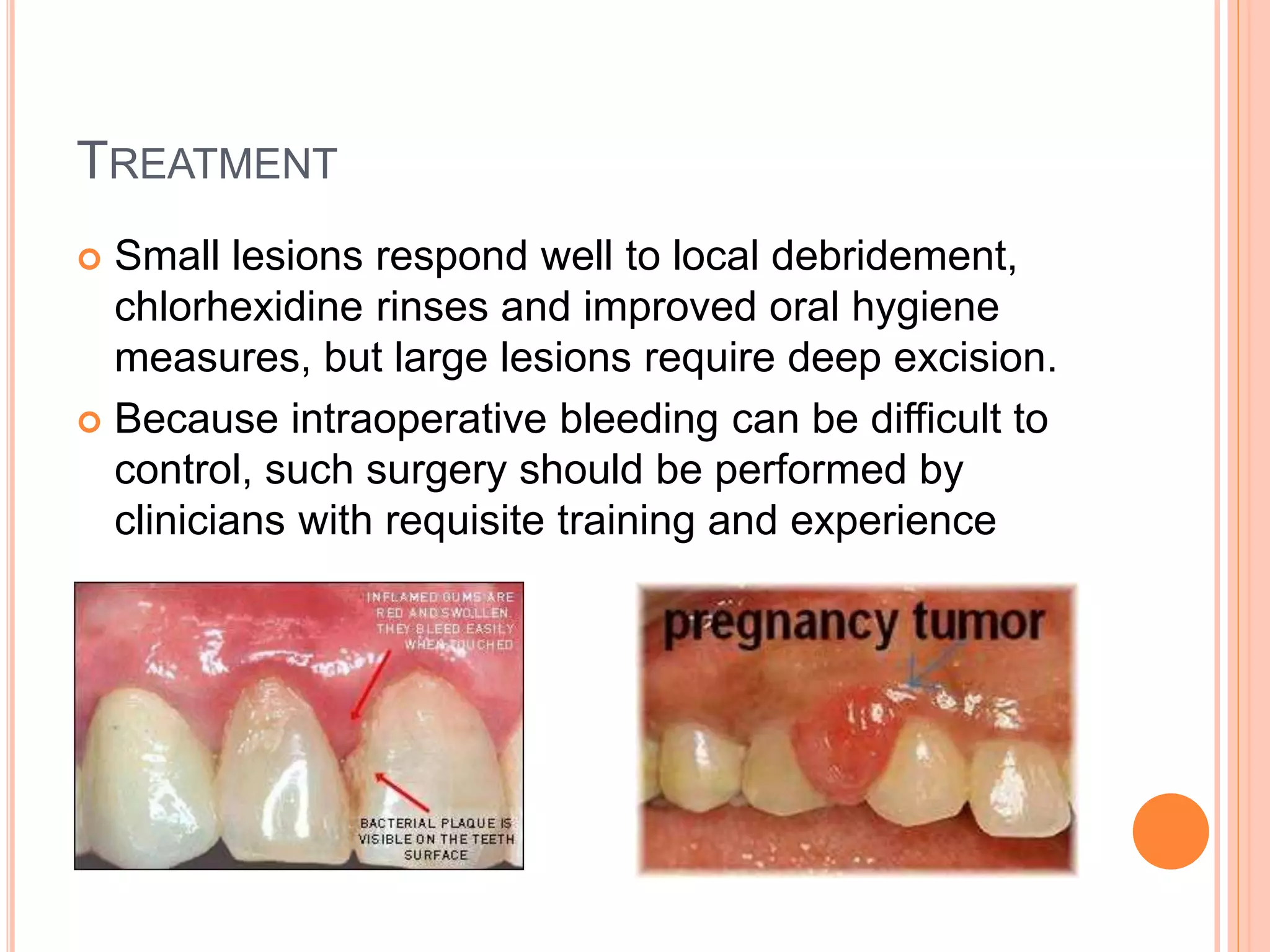 Oral healthcare in pregnancy protocol PPT
