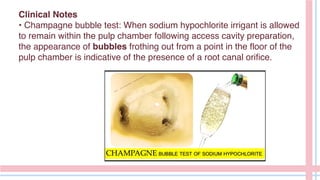 Clinical Notes
• Champagne bubble test: When sodium hypochlorite irrigant is allowed
to remain within the pulp chamber following access cavity preparation,
the appearance of bubbles frothing out from a point in the floor of the
pulp chamber is indicative of the presence of a root canal orifice.
 