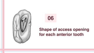 Shape of access opening
for each anterior tooth
06
 
