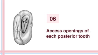 Access openings of
each posterior tooth
06
 